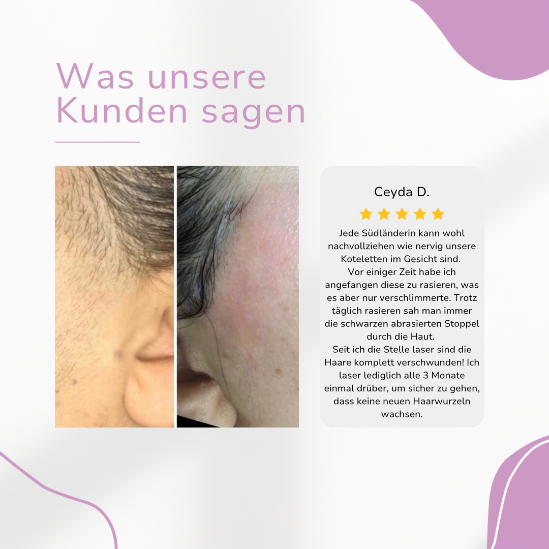 THARAH IPL Hair Remover I Die führende Laser-Haar-Entfernung für Zuhause