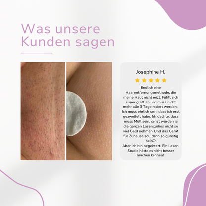 THARAH IPL Hair Remover I Die führende Laser-Haar-Entfernung für Zuhause