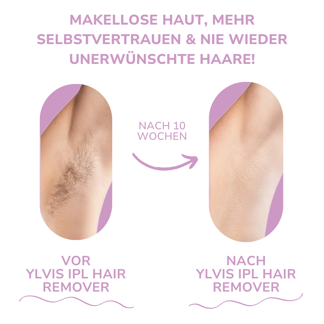 THARAH IPL Hair Remover I Die führende Laser-Haar-Entfernung für Zuhause