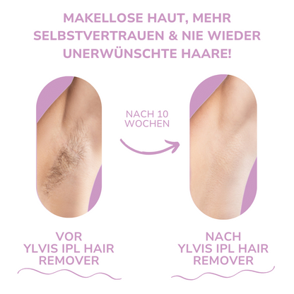 THARAH IPL Hair Remover I Die führende Laser-Haar-Entfernung für Zuhause